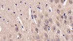 CK1 delta Antibody in Immunohistochemistry (Paraffin) (IHC (P))