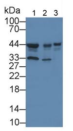 CK1 delta Antibody in Western Blot (WB)