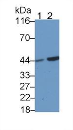 CK1 delta Antibody in Western Blot (WB)