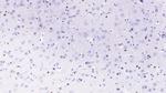 PCSK9 Antibody in Immunohistochemistry (Paraffin) (IHC (P))