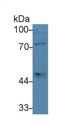 PCSK9 Antibody in Western Blot (WB)