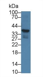 CRHBP Antibody in Western Blot (WB)