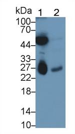 DTYMK Antibody in Western Blot (WB)