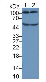 Complement C5a Antibody in Western Blot (WB)