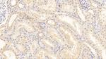 SERPINF2 Antibody in Immunohistochemistry (Paraffin) (IHC (P))