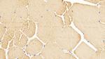 alpha-Cardiac Actin Antibody in Immunohistochemistry (Paraffin) (IHC (P))