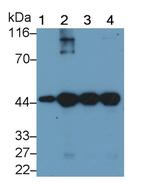 alpha-Cardiac Actin Antibody in Western Blot (WB)