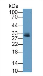 Tryptase Antibody in Western Blot (WB)