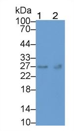 TK1 Antibody in Western Blot (WB)