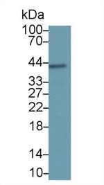 SERPINB3 Antibody in Western Blot (WB)