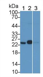 GSTP1 Antibody in Western Blot (WB)