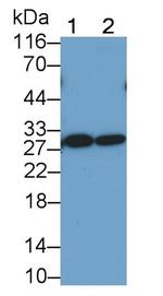 TIGIT Antibody in Western Blot (WB)