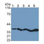 Cathepsin B Antibody in Western Blot (WB)