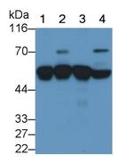 alpha-1 Antitrypsin Antibody in Western Blot (WB)