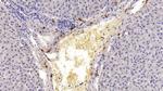 Tryptase Antibody in Immunohistochemistry (Paraffin) (IHC (P))