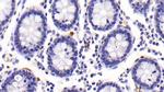 Tryptase Antibody in Immunohistochemistry (Paraffin) (IHC (P))