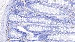 Tryptase Antibody in Immunohistochemistry (Paraffin) (IHC (P))