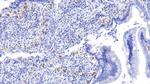 Tryptase Antibody in Immunohistochemistry (Paraffin) (IHC (P))