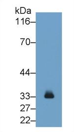 Tryptase Antibody in Western Blot (WB)