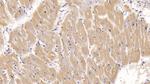 ACVR2A Antibody in Immunohistochemistry (Paraffin) (IHC (P))