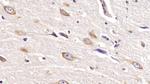 SHH Antibody in Immunohistochemistry (Paraffin) (IHC (P))