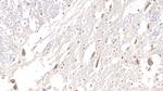 SHH Antibody in Immunohistochemistry (Paraffin) (IHC (P))