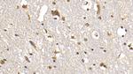 FAP Antibody in Immunohistochemistry (Paraffin) (IHC (P))