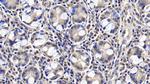 FAP Antibody in Immunohistochemistry (Paraffin) (IHC (P))