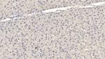 FAP Antibody in Immunohistochemistry (Paraffin) (IHC (P))