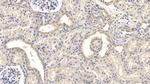 FAP Antibody in Immunohistochemistry (Paraffin) (IHC (P))