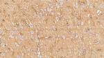 Aquaporin 4 Antibody in Immunohistochemistry (Paraffin) (IHC (P))