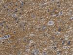 Aquaporin 4 Antibody in Immunohistochemistry (Paraffin) (IHC (P))