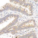 MMP3 Antibody in Immunohistochemistry (Paraffin) (IHC (P))