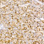 MMP3 Antibody in Immunohistochemistry (Paraffin) (IHC (P))