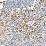 TRAF2 Antibody in Immunohistochemistry (Paraffin) (IHC (P))