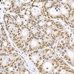 PRDM9 Antibody in Immunohistochemistry (Paraffin) (IHC (P))