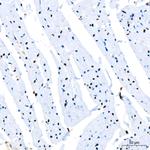 PARP1 Antibody in Immunohistochemistry (Paraffin) (IHC (P))