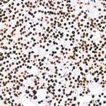 PARP1 Antibody in Immunohistochemistry (Paraffin) (IHC (P))