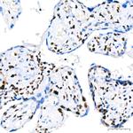 PARP1 Antibody in Immunohistochemistry (Paraffin) (IHC (P))