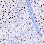 PARP1 Antibody in Immunohistochemistry (Paraffin) (IHC (P))