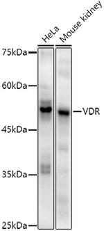 VDR Antibody in Western Blot (WB)