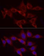 HK2 Antibody in Immunocytochemistry (ICC/IF)