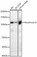 HK2 Antibody in Western Blot (WB)