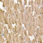 Cardiac Troponin I Antibody in Immunohistochemistry (Paraffin) (IHC (P))