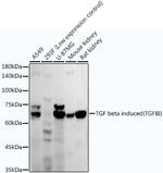 TGFBI Antibody in Western Blot (WB)