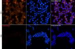 CHI3L1 Antibody in Immunocytochemistry (ICC/IF)