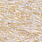 SIRT3 Antibody in Immunohistochemistry (Paraffin) (IHC (P))