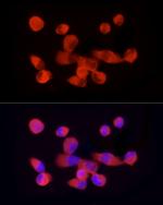 PKM2 Antibody in Immunocytochemistry (ICC/IF)