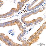 FGFR1 Antibody in Immunohistochemistry (Paraffin) (IHC (P))