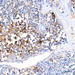 FGFR1 Antibody in Immunohistochemistry (Paraffin) (IHC (P))